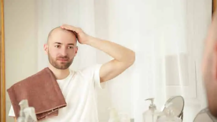 Hair loss concept