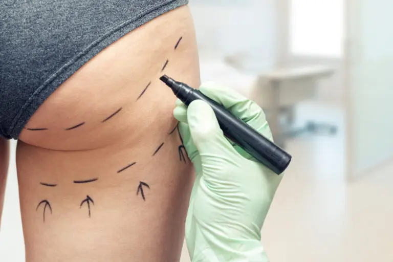 New curbs on cosmetic surgery ads