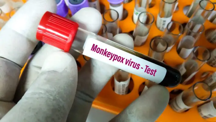 Blood,Sample,Tube,For,Monkeypox,Virus,Test.,It,Is,Also