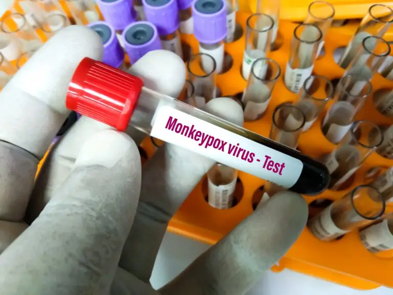 Blood,Sample,Tube,For,Monkeypox,Virus,Test.,It,Is,Also