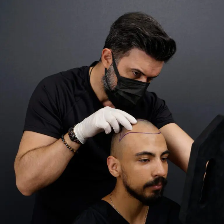Vera Clinic is the go-to place for hair transplant Turkey surgery. We provide the highest level of care at Vera Clinic.