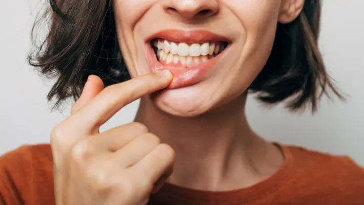 Gum disease is far from a pleasant experience and can wreak havoc on your oral health if not addressed promptly.