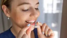 In recent years, Invisalign has become one of the most sought-after orthodontic solutions in Singapore. With its clear aligners, discreet appearance, and modern treatment approach, Invisalign appeals to both working professionals and teenagers who want straighter teeth without traditional metal braces.