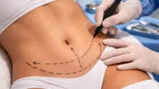 Changes in body weight, pregnancy, and the natural aging process can all influence how fat is distributed and how the skin adapts over time.