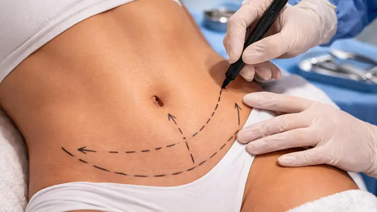 Changes in body weight, pregnancy, and the natural aging process can all influence how fat is distributed and how the skin adapts over time.
