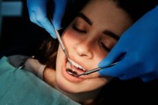 When you or a family member needs a wisdom tooth removed, one of the first concerns is how much it will cost.