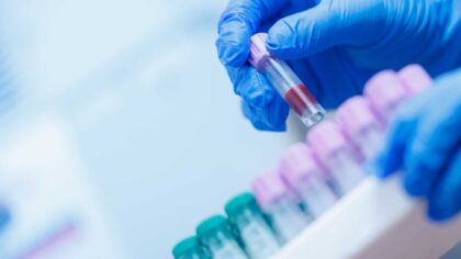 Automation can help laboratories process samples efficiently while supporting accuracy, traceability, and repeatable workflows. It does not replace the knowledge of trained scientists and laboratory professionals. Instead, it provides tools that help teams manage complex tasks at scale.